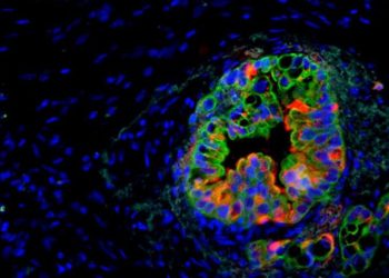 Cientista brasileira cria ‘caneta’ que detecta câncer durante cirurgia