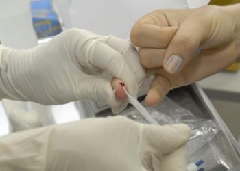 Alunos de medicina promovem dia de aconselhamento sobre HIV/Aids na Rodoviária do Plano Piloto