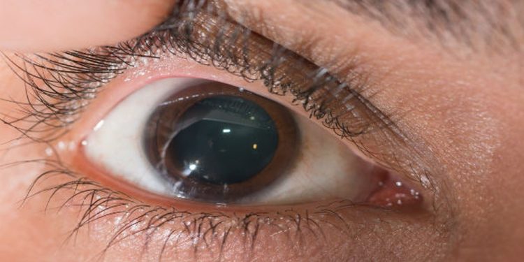 Brasília sedia corrida pela visão neste sábado