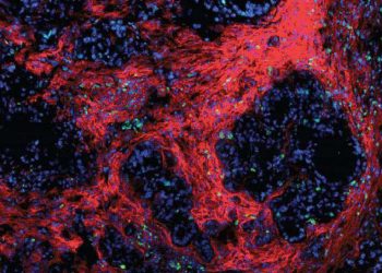 Novo tratamento se mostra promissor contra o câncer de pâncreas