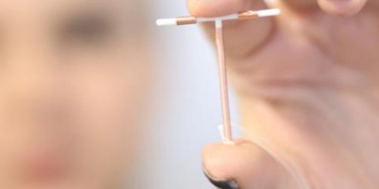 Postos de Saúde do DF oferecem DIU gratuitamente