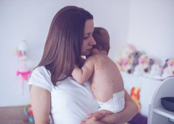 Sarampo: surto da doença atinge 16 estados