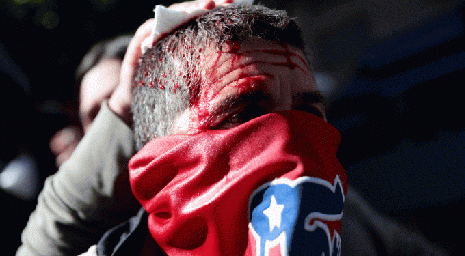 ONU enviará missão ao Chile para investigar violações de direitos humanos