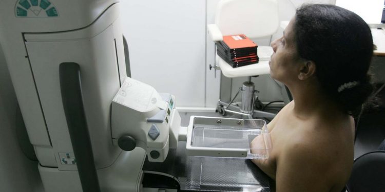 Mortalidade por câncer de mama no Brasil está abaixo da média mundial