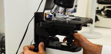 Brasileira desenvolve novo tratamento para câncer de ovário