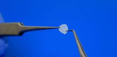 Brasil envia pele humana para vítimas de acidente no Peru