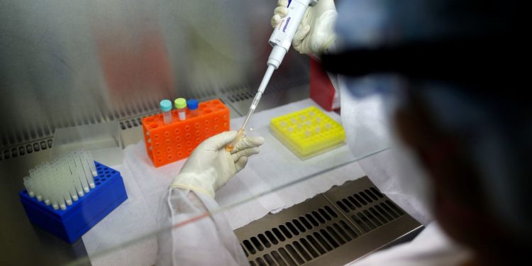 Buenos Aires aumenta restrições para frear contágio de covid-19