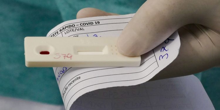 Brasil chega a 2 milhões de casos acumulados de covid-19