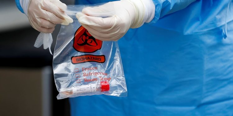 BID: teste em larga escala é fundamental para retomada de atividades