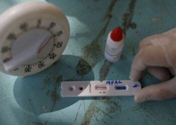Butantan oferece testagem gratuita de covid-19 na capital paulista