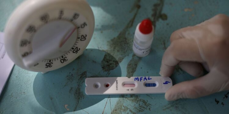 Butantan oferece testagem gratuita de covid-19 na capital paulista