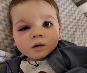 Mãe faz alerta depois que bebê quase perdeu a visão por usar brinquedos de banho mofados