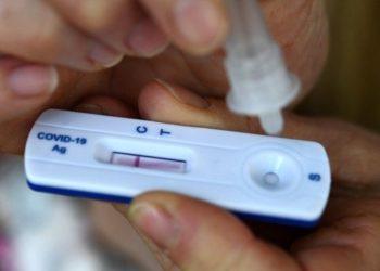 Anvisa decide nesta quarta-feira liberação de autotestes de Covid-19