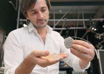 O implante que fez três paraplégicos voltarem a andar; entenda como funciona