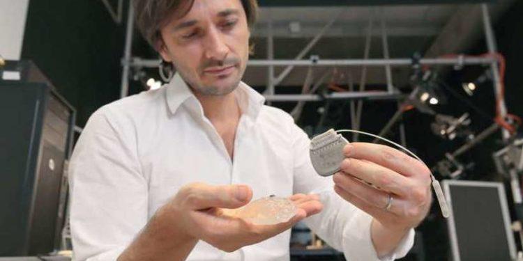 O implante que fez três paraplégicos voltarem a andar; entenda como funciona