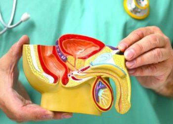 Ferida no pênis pode indicar câncer: ‘Diagnóstico precoce é essencial para evitar amputação’