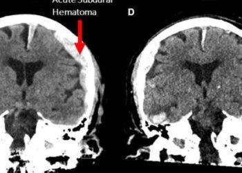 Como cientistas mostraram que vida passa mesmo como filme antes da morte