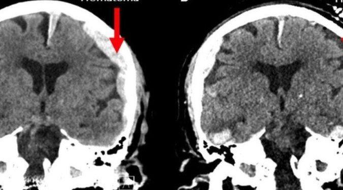 Como cientistas mostraram que vida passa mesmo como filme antes da morte