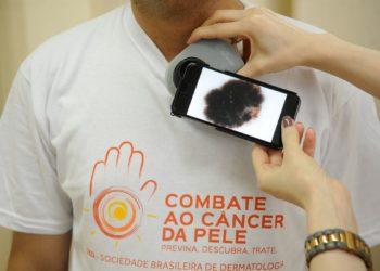 Guia procura esclarecer relação entre covid-19 e lesões de pele
