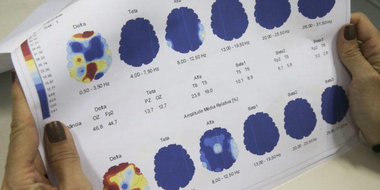 Março Roxo quer conscientizar população sobre a epilepsia