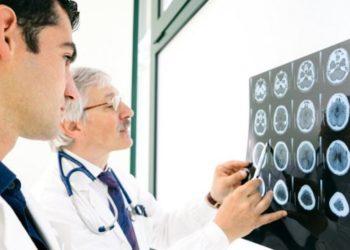 O que é demência vascular e como ela se diferencia do Alzheimer