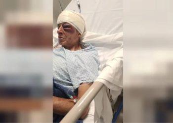 Idoso é vítima de tentativa de latrocínio no DF e fica em estado grave