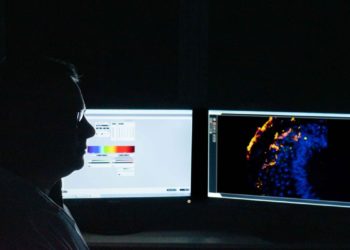 Estudo busca identificar tratamento gênico para Síndrome de Pitt-Hopki