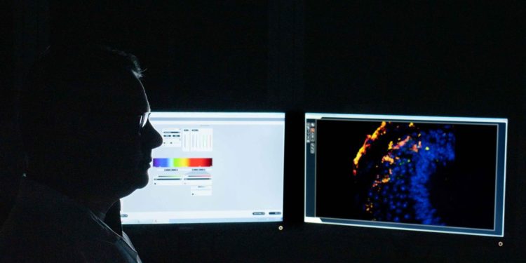 Estudo busca identificar tratamento gênico para Síndrome de Pitt-Hopki