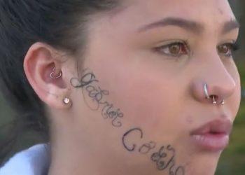 Jovem passará por procedimento para retirar tatuagens feitas pelo ex