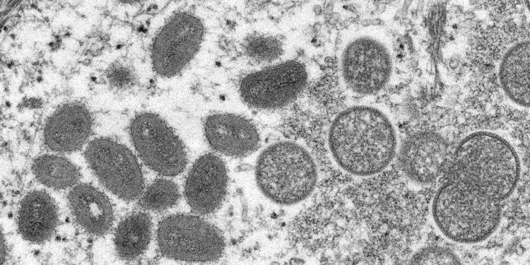 DF registra primeiro caso suspeito de varíola dos macacos