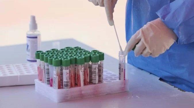 Segundo caso de Varíola dos Macacos é confirmado no Brasil