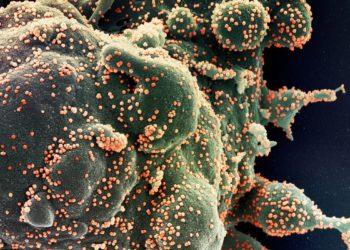 Fiocruz usa sequenciamento de DNA para pesquisar covid grave em jovens