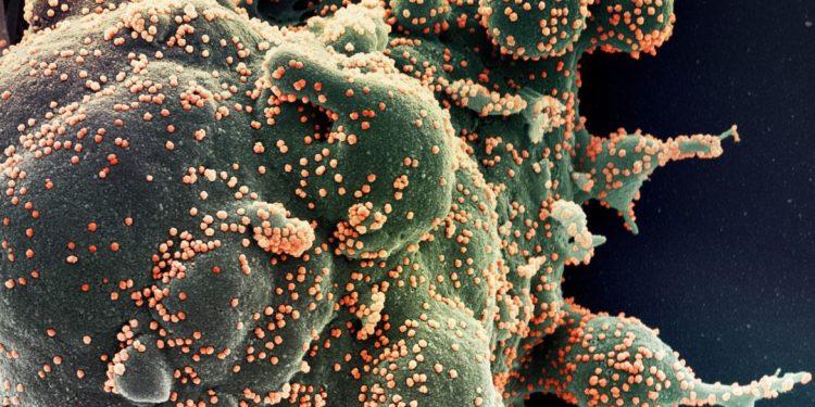 Fiocruz usa sequenciamento de DNA para pesquisar covid grave em jovens