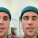Justin Bieber aparece com metade do rosto paralisado: “Eu confio em Deus”