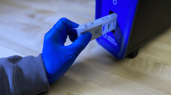 Pesquisadores identificam método capaz de prever gravidade da covid-19