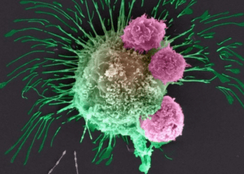 Células cancerígenas circulantes se espalham mais durante o sono, diz estudo