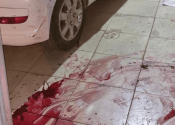 Homem é preso ao tentar matar familiar a facadas em Taguatinga