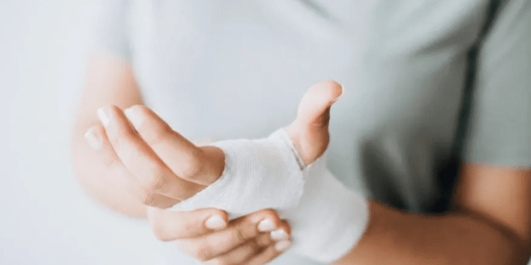 Saúde alerta para acidentes que causam queimaduras em festas juninas