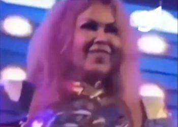 Sequelas da Covid podem causar inchaço? Entenda o caso de Joelma