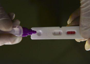 Covid-19: Brasil notifica 365 óbitos e 72 mil casos em 24 horas