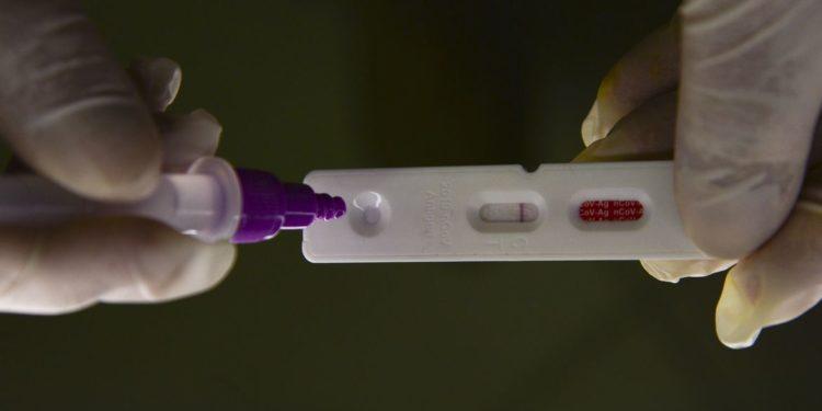 Covid-19: Brasil notifica 365 óbitos e 72 mil casos em 24 horas