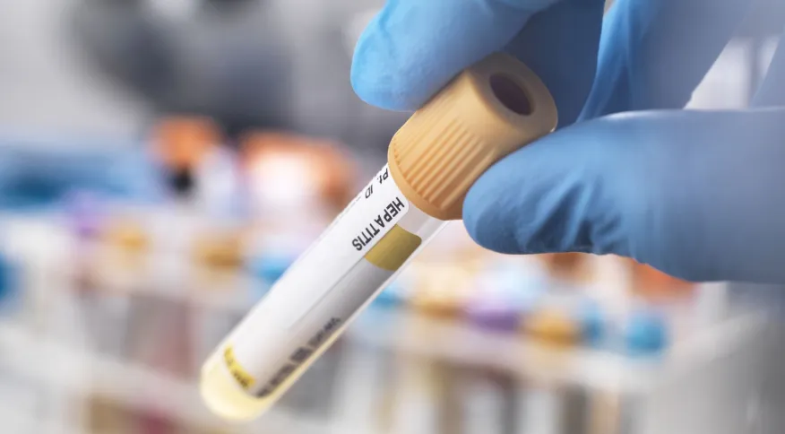 OMS: mundo tem 700 casos prováveis e 10 mortes por hepatite de causa desconhecida em crianças