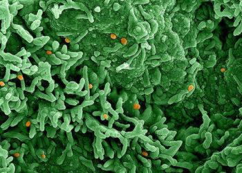 São Paulo monitora primeiro caso suspeito de varíola do macaco