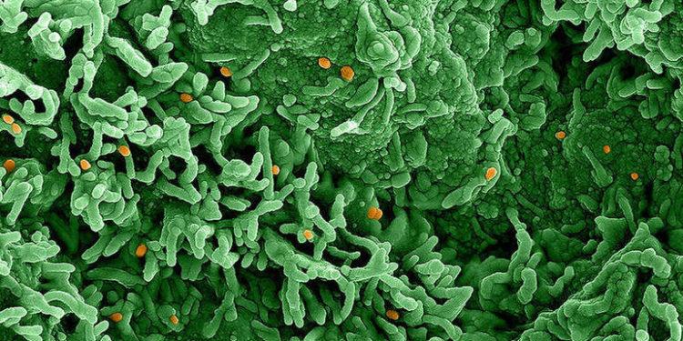 São Paulo monitora primeiro caso suspeito de varíola do macaco