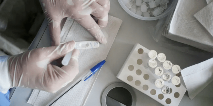 Média móvel de mortes por Covid-19 tem sexto dia em queda, segundo Conass