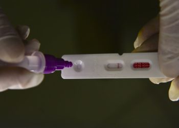 Brasil registra 18,5 mil novos casos e 53 mortes por covid-19