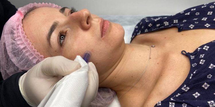 Skinbooster é alternativa para recuperar a pele durante a seca