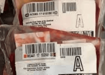 Tipo sanguíneo influencia risco de AVC; veja quais são os mais vulneráveis