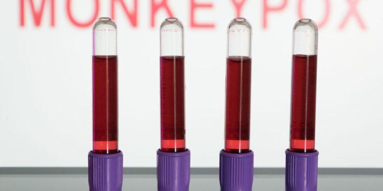 Iniciam nos EUA ensaios clínicos de vacina contra a varíola dos macacos