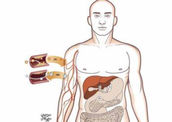 Tratamento: veja como identificar e prevenir o colesterol alto